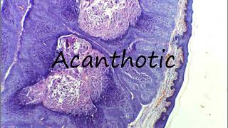 How to Pronounce Acanthotic [upl. by Gibbons]