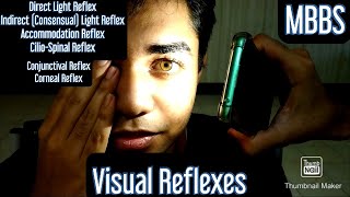 Visual Reflexes Direct Light Reflex Indirect Consensual Light Reflex Accommodation Reflex mbbs [upl. by Katlin684]