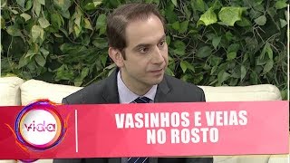 Vasinhos e veias no rosto Conheça os tratamentos para eliminálos  Vida Melhor  171018 [upl. by Sivlek]