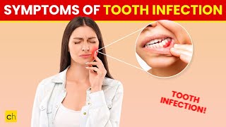 10 Symptoms of a Tooth Infection You Shouldnt Ignore  Credihealth toothpainrelief tooth [upl. by Ahcsap]