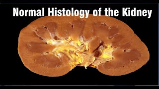 Normal Histology of the Kidney Dr OJAS GUPTA Pathology SGPGIMS Lucknow [upl. by Dressler81]