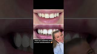 REAL TRANSFORMATIONS 🤯 transformation lifestyle teethwhitening love tiktok shorts selfcare [upl. by Patterson950]