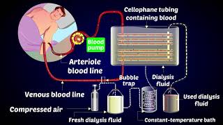 How a Dialysis Machine Works  Dialysis  ARTIFICIAL KIDNEYS [upl. by Neddra960]