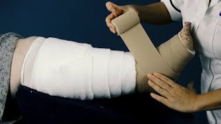 Clinistretch Multi Layer Compression Bandaging for Lower Limb [upl. by Sualokcin]