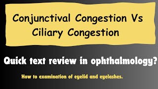 How to differentiate between Conjunctival Congestion and ciliary Congestion OptometryFans [upl. by Jimmy932]