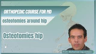 Osteotomies hip  pediatric Orthopedic course كورس عظام ماجستير ودكتوراه د محمد تاج الدين [upl. by Zoldi]