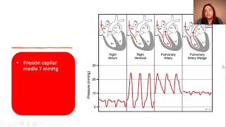 Fisiología  VQ Ventilación y Perfusión parte 3 ASINCRÓNICA [upl. by Portwine]