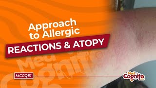 Approach to Allergic Reactions amp Atopy  MCCQE1 [upl. by Cupo879]