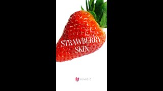 Come contrastare la pelle a fragola  strawberry skin [upl. by Yeslek255]