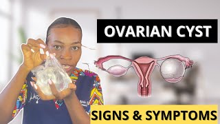 OVARIAN CYSTS Causes symptoms and Ovarian cyst treatment [upl. by Hildegaard]