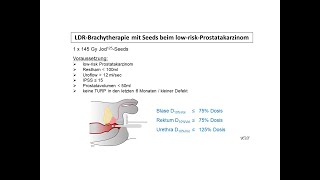 LDRBrachytherapie mit Seeds beim Prostatakarzinom  Strahlentherapie Prof Hilke Vorwerk [upl. by Reehsab214]