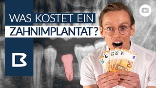 ZahnIMPLANTAT KOSTEN Was muss ICH zahlen Was zahlt die Krankenkasse Alles GENAU erklärt [upl. by Winebaum111]