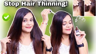 My Real Hair Thinning Story  How I Regrew My Hair ft Bare Anatomy Advanced Hair Growth serum [upl. by Thilde]