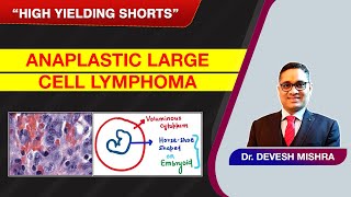 High Yielding Shorts90 HYS90Anaplastic Large cell Lymphoma by Dr Devesh Mishra [upl. by Beale]