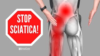 How to Relieve Sciatica Pain in SECONDS [upl. by Iney]