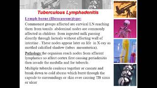 Lymphadenopathy [upl. by Anaul]