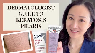 Dermatologist Guide to KP  Keratosis Pilaris Chicken Skin [upl. by Kora546]