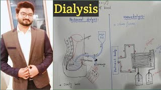 Dialysis  procedure explain in urdu in detail  peritoneal dialysis  haemodialysis  fsc biology [upl. by Richers]