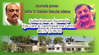 Bengaluru Diabetic Macular edema vision improved in AYURVEDASudarshanam [upl. by Aneeuqal]