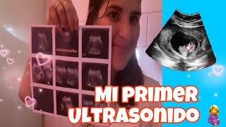 MI PRIMER ULTRASONIDO 🥺🤰 ultrasonido embarazo familia vlog viralvideo [upl. by Nosiram620]