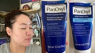 PanOxyl 10 vs 4 Acne Foaming Wash  Which is better for your skin [upl. by Wiltsey]