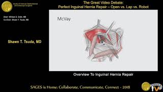 Overview inguinal hernia repair [upl. by Ahsinot302]