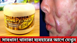 Thanaka Face Pack Review  মিয়ানমারের থানাকা ব্যবহার করে কেমন রেজাল্ট পেলাম Thanka Facepack [upl. by Quill912]