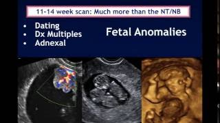 AIUM Webinar Systematic Evaluation of the 1114 Week Fetus Touching on ISUOG Guidelines [upl. by Giannini528]