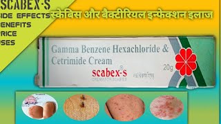 scabexs scabex s cream price scabex s cream for scabies scabex s cream benifits scabex s cream in [upl. by Aloisius]