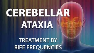 Cerebellar Ataxia  RIFE Frequencies Treatment  Energy amp Quantum Medicine with Bioresonance [upl. by Bink]