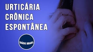 URTICÁRIA CRÔNICA ESPONTÂNEA  UCE  SÉRIE SAÚDE BRASIL [upl. by Anitsyrhc30]