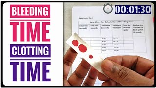 BT CT Test  Bleeding Time AND Clotting Time Coagulation Time Blood Test [upl. by Kieger]