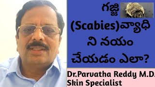 How to cure and control Scabies [upl. by Assilym]