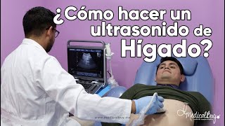 ANATOMÍA  Anatomía del Hígado y vías biliares  Blasto Med [upl. by Knarf]