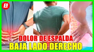 DOLOR DE ESPALDA BAJA LADO DERECHO  Cálculo Renal y Ureteral o Pielonefritis [upl. by Jacqui]