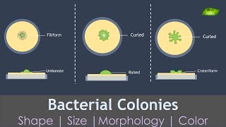 Bacterial Colony Classification  Microbiology  Basic Science Series [upl. by Zanze]