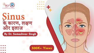 Sinus के कारण लक्षण और इलाज  Sinusitis Treatment  By Dr Someshwar Singh [upl. by Clemence]