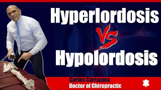 🟢 Hyperlordosis vs Hypolordosis Whats going on 🤔 [upl. by Hurff]