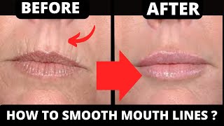 EASY FACIAL EXERCISES FOR MOUTH LINES  HOW TO GET RID OF WRINKLES AROUND MOUTH  MOUTH LINES [upl. by Bo42]