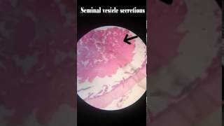 Seminal Vesicle Histology [upl. by Eirehc]