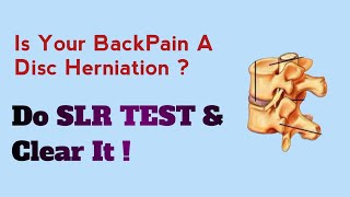 How To Perform SLR Test For Disc Slip  BackPain Treatment  Sciatica [upl. by Marasco74]