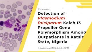 Detection of Plasmodium falciparum Kelch 13 Propeller Gene Polymorphism Among Outpatients [upl. by Hachmin]