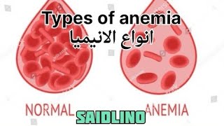 انواع الأنيميا شرح للطاقم الطبي Types of anemia [upl. by Ttik]