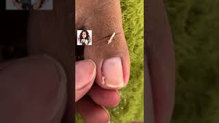 Satisfying Toe Cleaning  Relaxing Foot Care amp Deep Clean ASMR 94 [upl. by Loomis]