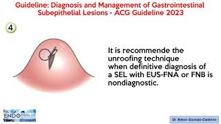 ACG Guideline Diagnosis and Management ofGastrointestinal Subepithelial Lesions  2023 [upl. by Evin]