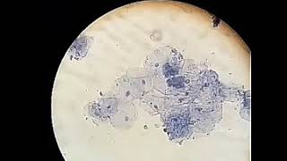 Les cellules de l’épithélium buccal [upl. by Troy]