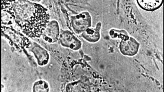 Normal and abnormal white blood cells in tissue cultures [upl. by Rizan561]