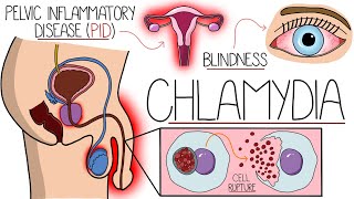 Understanding Chlamydia Chlamydia Trachomatis Explained Clearly [upl. by Adnylam599]