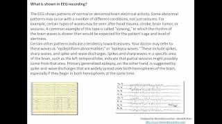 Understanding EEG Part 6Machine used in EEG diagnostic application signal recorded clinical use [upl. by Rozek]