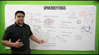 Spherocytosis  Spherocytosis in Hindi  Spherocytosis Pathology  Spherocytosis Sign amp Symptoms [upl. by Yleoj338]